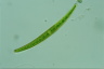 Closterium intermedium