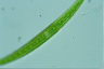 Closterium intermedium