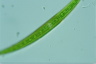 Closterium intermedium