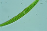 Closterium intermedium