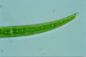 Closterium rostratum