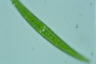 Closterium rostratum