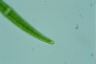 Closterium rostratum