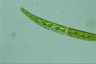 Closterium intermedium