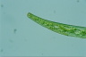 Closterium intermedium