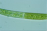 Closterium intermedium