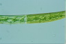 Closterium intermedium