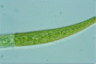 Closterium intermedium