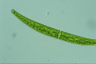 Closterium intermedium