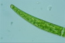 Closterium intermedium