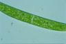 Closterium intermedium