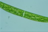 Closterium intermedium