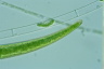 Closterium rostratum