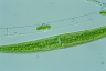 Closterium rostratum