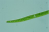 Closterium abruptum