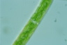 Closterium intermedium