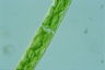 Closterium intermedium