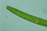 Closterium baillyanum