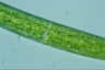 Closterium baillyanum