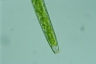 Closterium baillyanum