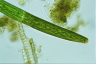 Closterium baillyanum