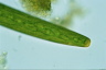 Closterium baillyanum