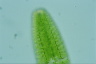 Netrium digitus