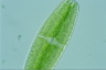 Netrium digitus