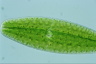 Netrium digitus