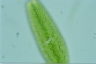 Netrium digitus