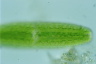 Netrium digitus