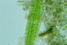 Netrium digitus