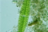 Netrium digitus