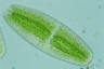 Netrium digitus