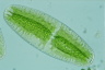 Netrium digitus