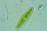 Netrium digitus