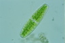 Netrium digitus