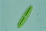 Netrium digitus