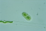 Cylindrocystis