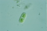 Cylindrocystis