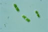 Cylindrocystis