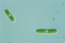 Cylindrocystis