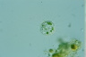 Acanthocystis