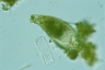 Cyphoderia ampulla