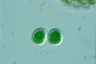 Chroococcus turgidus