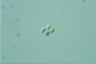 Chroococcus