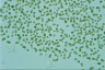 Microcystis