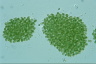 Microcystis