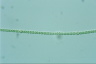 Anabaena