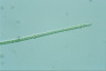 Anabaena